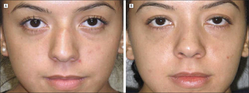 patient before and after