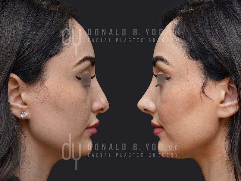 Before and After Patient Reflection View