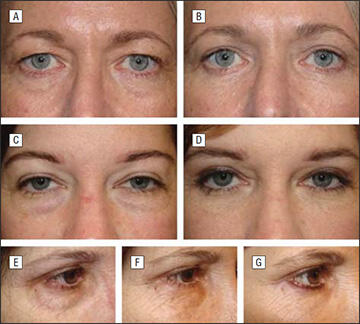 Preoperative and postoperative photos