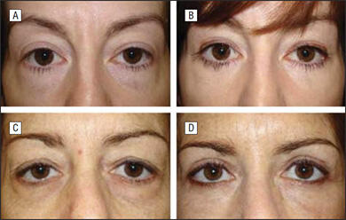 Preoperative and postoperative photos
