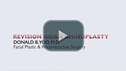 Revision Asian Rhinoplasty