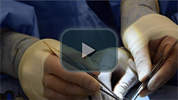 Making DCF - Suturing Fascia