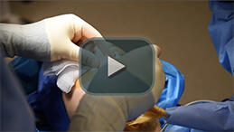 Making an incision on the nose