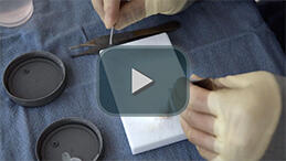 Making grafts with Rib cartilage